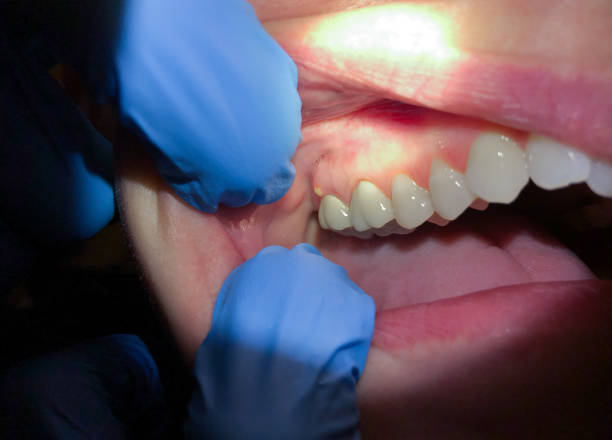 Best Emergency TMJ Treatment in Alamo Heights, TX